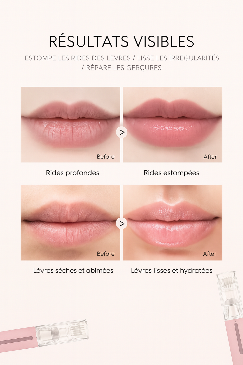 KIMEA LIP GLOW™ — Rouleau Microneedling Lèvres